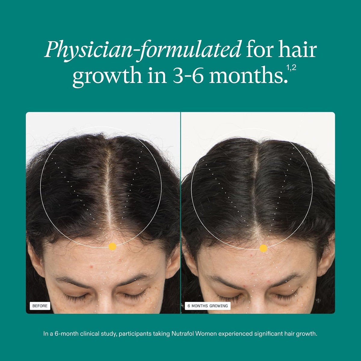 Nutrafol Hair Loss & Thinning Supplement for Women, 120 Capsules